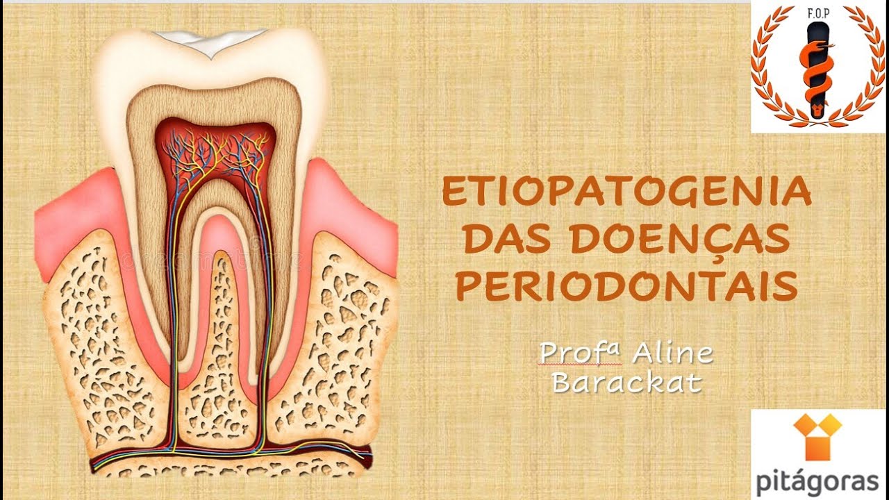 ODONTO PRÉ CLÍNICA (DENTÍSTICA E PERIO) - 20210903 - ETIOPATOGENIA DAS DOENÇAS PERIODONTAIS