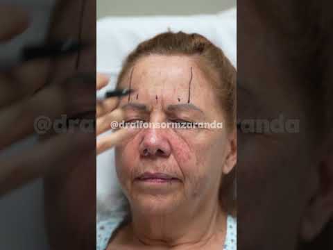 Alfonso Ramírez Aranda-65
