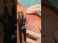 Heat Rash 5 Things To Do About It Shorts Learnonyoutube Doctor