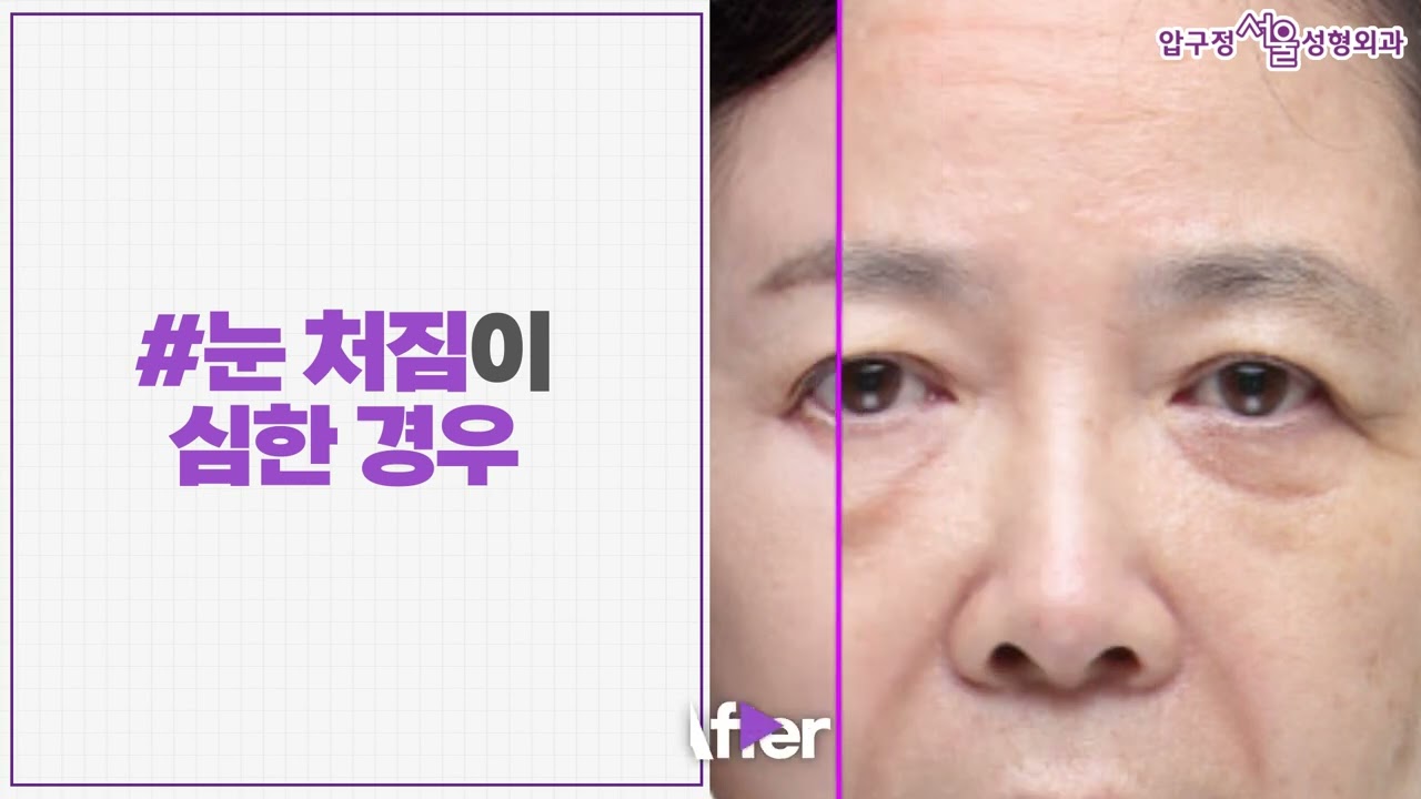 �� ���ָ��� ������?