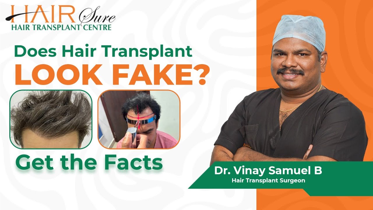 Achieve Natural Hair Restoration with Dr. Vinay | Best Hair Transplant in Hyderabad | Hairsure