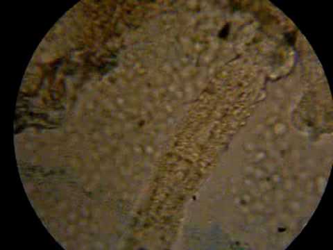 Lyambliya allatto di trattamento di bambini da aglio Bioresonant diagnostics su parassiti Mosca