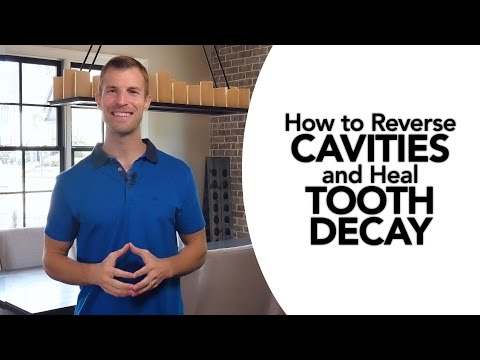 How to Treat Cavities and Reverse Tooth Decay Naturally