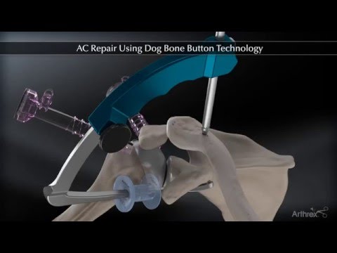 AC Repair Using Dog Bone™ Button Technology