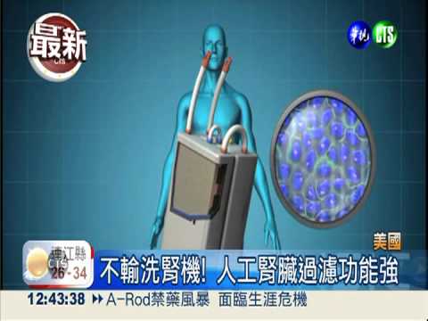 人工腎臟植體內 洗腎患者福音!