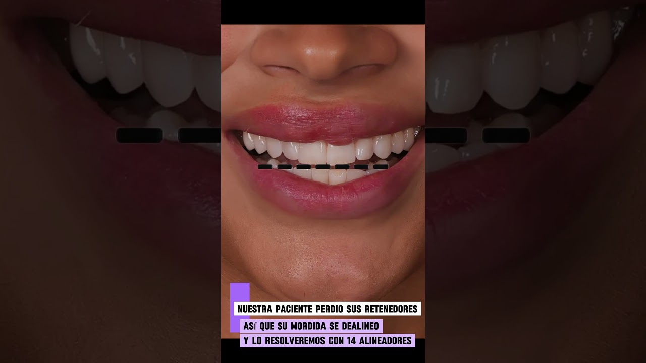 José Luis Mercadante Gutiérrez-111