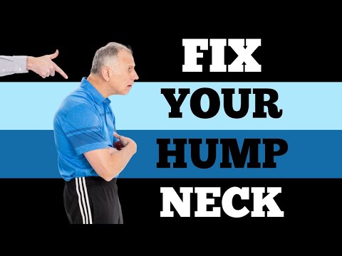 Single Best Fix (6 Min) for Neck Hump (Buffalo Hump)