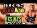 IFBB PRO Post Cycle / Post Contest Blood Work - Results REVEALED!