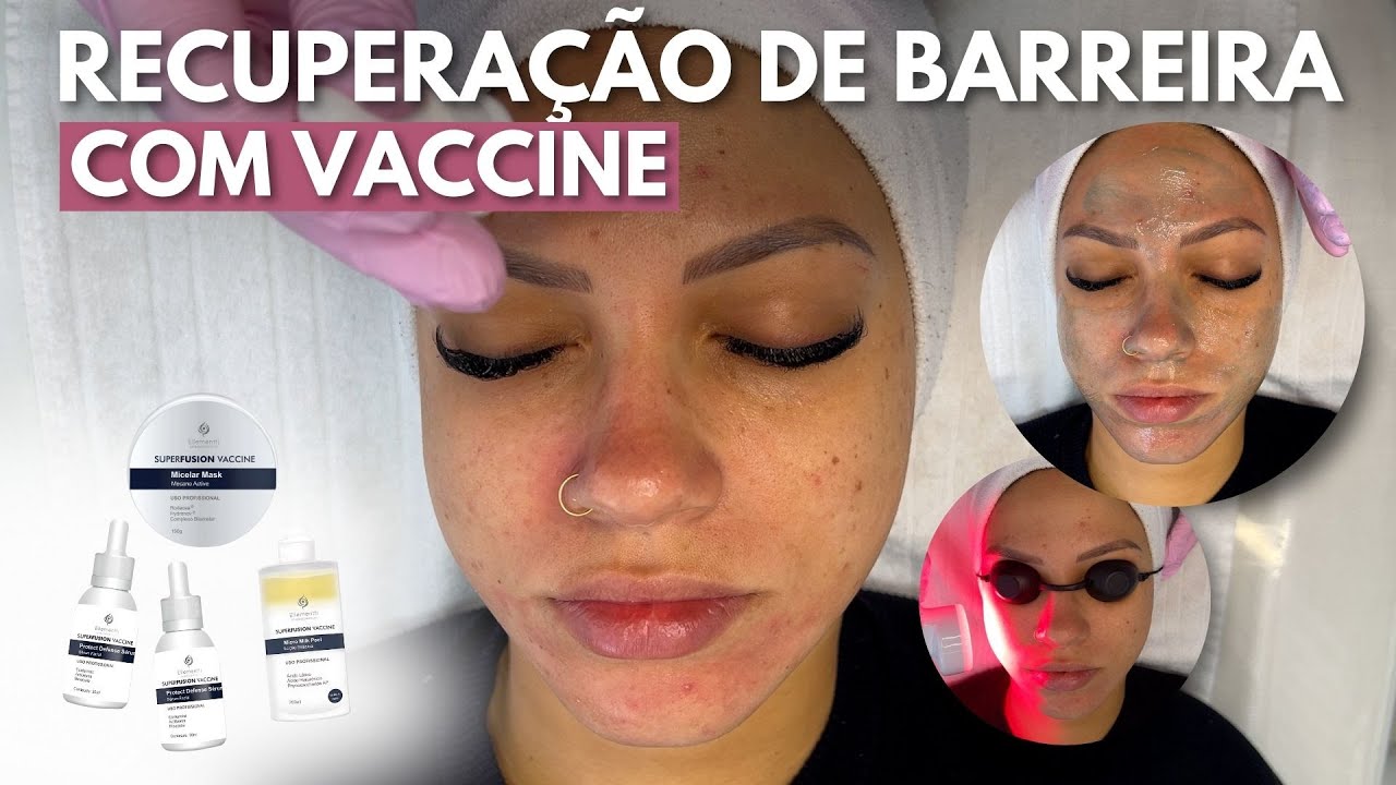 BARRIER RECOVERY PROTOCOL - VACCINE ELLEMENTTI