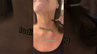 Legally Maimed