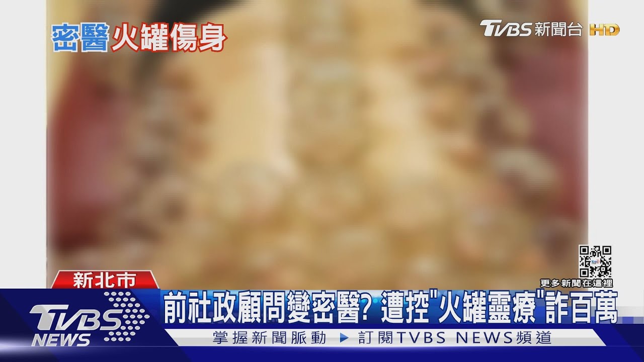 前社政顧問變密醫? 遭控「火罐靈療」詐百萬