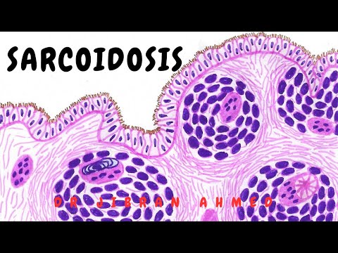 LUNG TUMOURS II SYSTEMIC PATHOLOGY II ROBBINS 10TH E II PATHOLOGY LECTURES II DrJIBRANAHMED