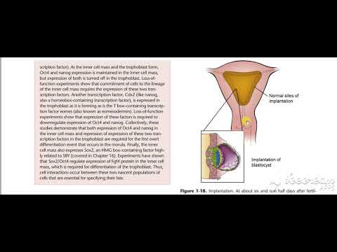 Ectopic pregnancy