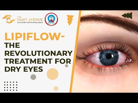 Lipiflow- The Revolutionary Treatment for Dry Eyes at The Sight Avenue