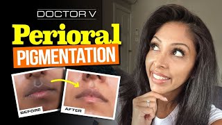Doctor V - Perioral Pigmentation | Skin Of Colour | Brown Or Black Skin
