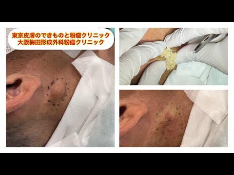 形成外科について詳しく解説