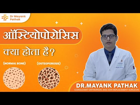 Understanding Osteoporosis| Dr. Mayank Pathak | Bone Health Tips