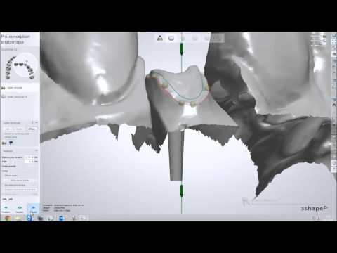 YouTube video