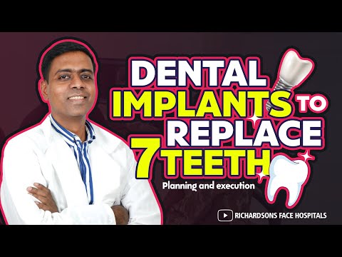 Video Of The Dental Implant