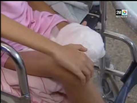 Najwa Awane victime du Pit Bull