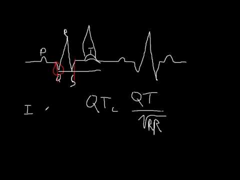 Intro to ECG's Part V - T waves and axis deviation