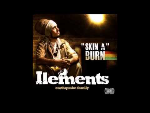 Ilements - Skin a burn