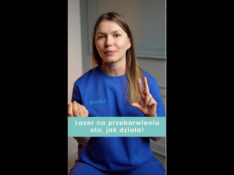 Jak działa laser na PRZEBARWIENIA? 💡