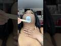 10 08 24 Full Face Wax Vibes Ft Tresswellness Facewax Hardwax Pcos Hirsutism Waxtutorial