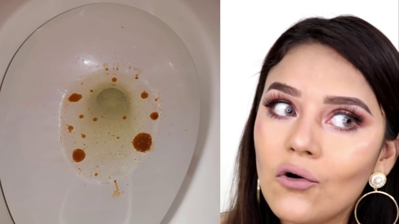 RETO: TOMÉ ORLISTAT (CAPSULAS) POR 15 DÍAS Y ÉSTO PASO