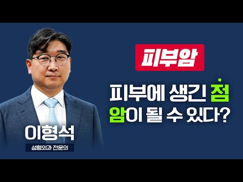 햇빛 쨍쨍한 여름, 피부에 생긴 점이 암이 될 수 있다고?? I 이형석 성형외과 전문의 [TV닥터인사이드]