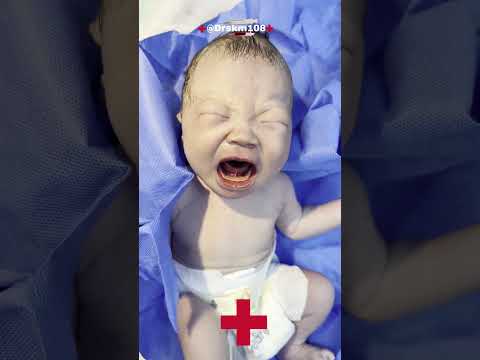 new born baby normal 😭delivery pregnant#mom#babycare#hospital#short@DrSkm108