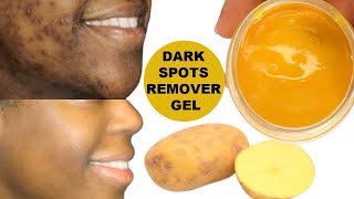 YOUR DARK SPOTS WILL BE GONE OVERNIGHT, APPLY AT NIGHT TO DARK SPOTS, WAKE UP WITH CLEAR SKIN.