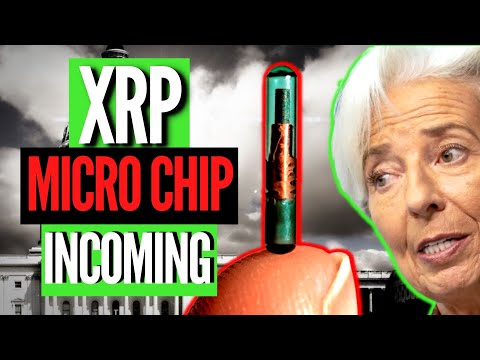 RIPPLE HAND MICRO CHIP INCOMING: The Future Of Payments
