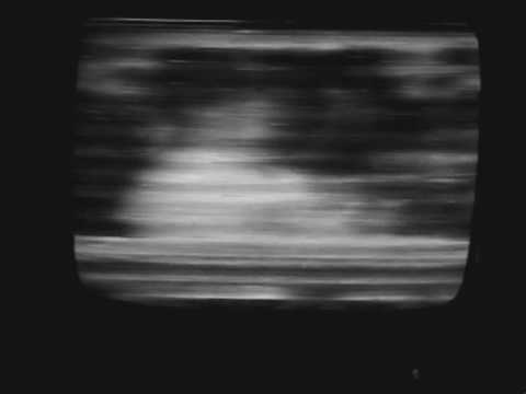 Venezuela Ch A2 TVDX in Portugal