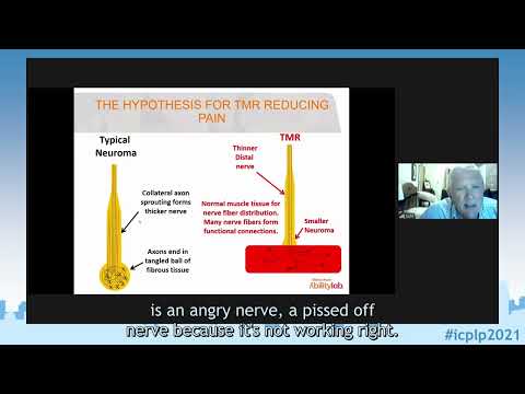 ICPLP2021 - Prof. Kuiken: Targeted Muscle Reinnervation for the treatment of Postamputation Pain