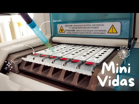 How to use Mini Vidas Hormone Analyzer | The only video you need to watch 🌸🔬