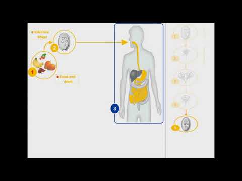 Giardiasis dyskinesia esetén