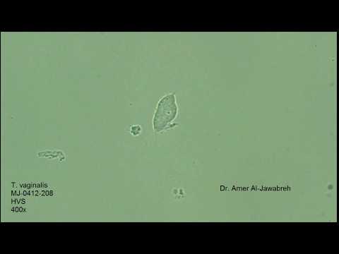 baktériumcsepp a parazitákból aki a gyártó endokardiális tabletták férgektől