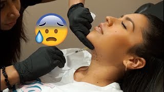 ME QUITE LA PAPADA! KYBELLA Mi experiencia - Ydelays