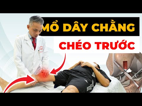 SỐC: 85% Người Phục Hồi Sau Mổ ACL THẤT BẠI Vì Bỏ Qua 4 Điều Này!