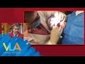 ¿Por qué me huele la boca aunque me lave los dientes? ¿Por qué me huele la boca aunque me lave los dientes?
