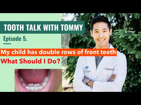 What Should Parents Do If the Child's New Front Teeth Are Coming in Behind Their Baby Teeth?