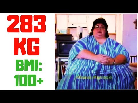 Ich kann nicht abnehmen: "Ich wiege 283 kg und bin die Schönste von allen!" [Doku]
