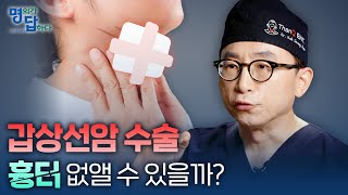 땡큐서울의원 하정훈 원장 갑상선암 수술 흉터