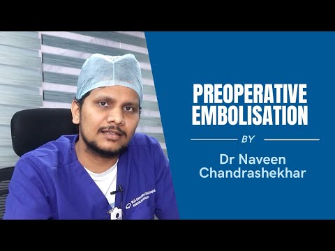 Preoperative Embolisation Best Explained By Dr. Naveen Chandrashekhar