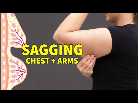 DAY 10 | SAGGING ARMS & CHEST  | 10 DAYS UPPER BODY CARDIO WORKOUT PLAN