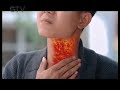 Iklan Adem Sari Chingku Macam Macam Panas Dalam 15