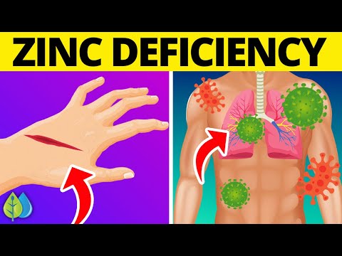 , title : '⚡Top 15 Signs of Zinc Deficiency You Need To Know'