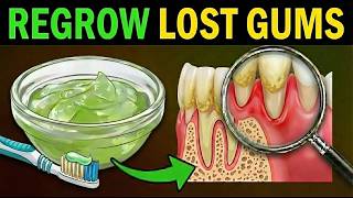 7 Gum Regrowth Secrets Your Dentist Won't Tell You