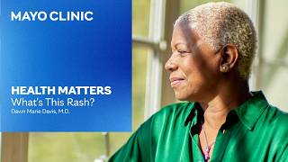 Dermatitis Explained: Eczema, Dandruff and Rashes | Mayo Clinic Health Matters Podcast